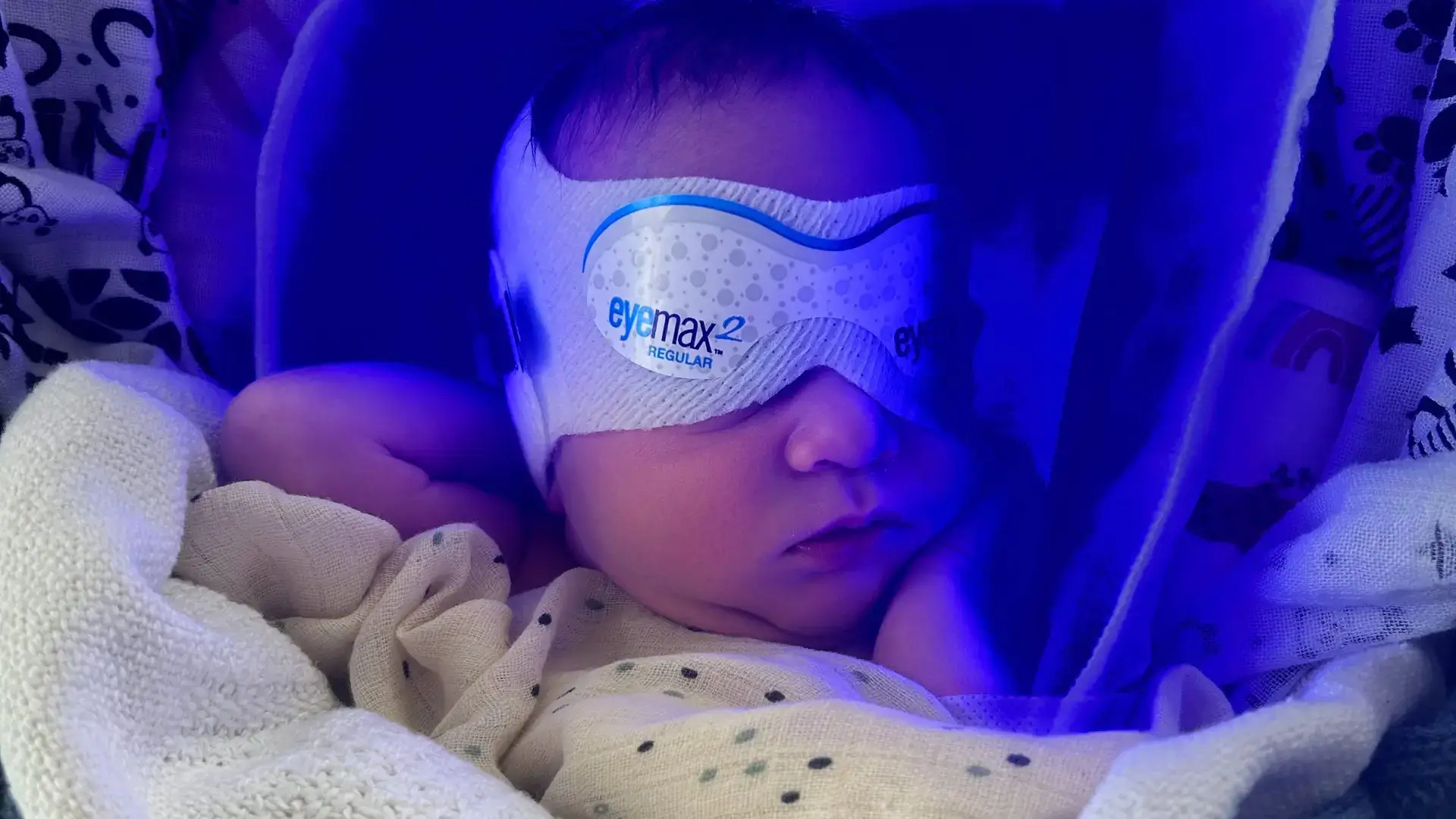 Very small baby wearing a mask covering his eyes, with a blue-ish light surrounding him